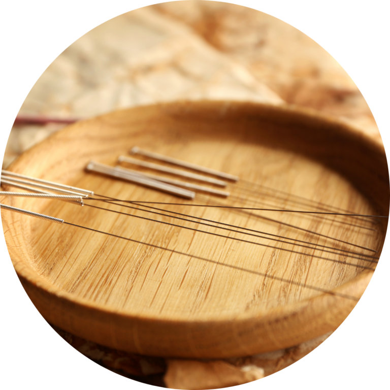Acupuntura e Medicina Tradicional Chinesa